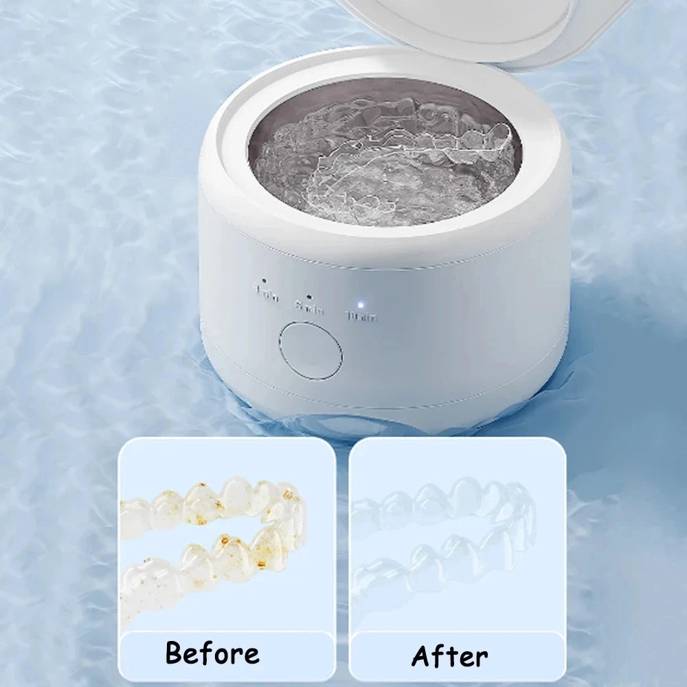 Ultrasonic Cleaner for Braces, Glasses & Jewelry – USB Rechargeable Cleaning Bath